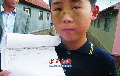 还用玩具击打小张的后脑勺,导致他的脸三次碰在桌子上,鼻梁骨轻微骨折