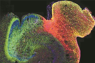 正在發育的人類海馬體的熒光圖像。圖片來源：美國加州大學舊金山分校